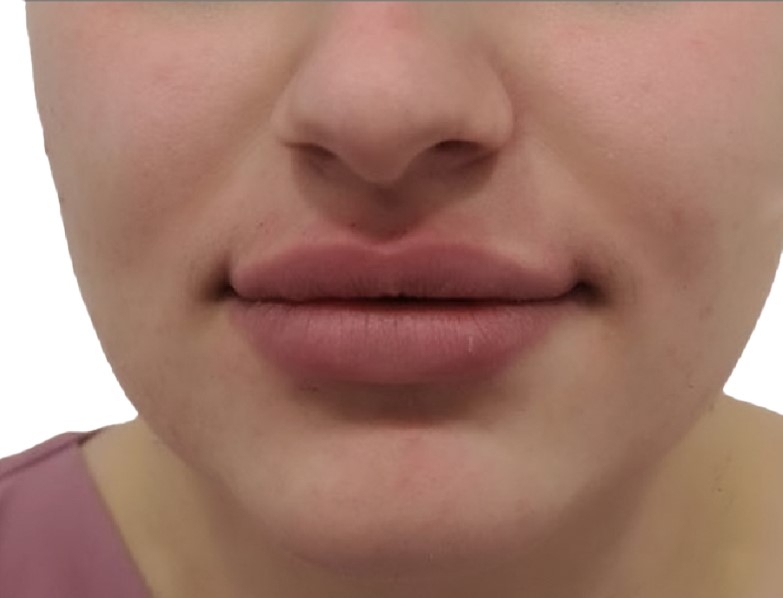 Aesthetic Treatment Dubai