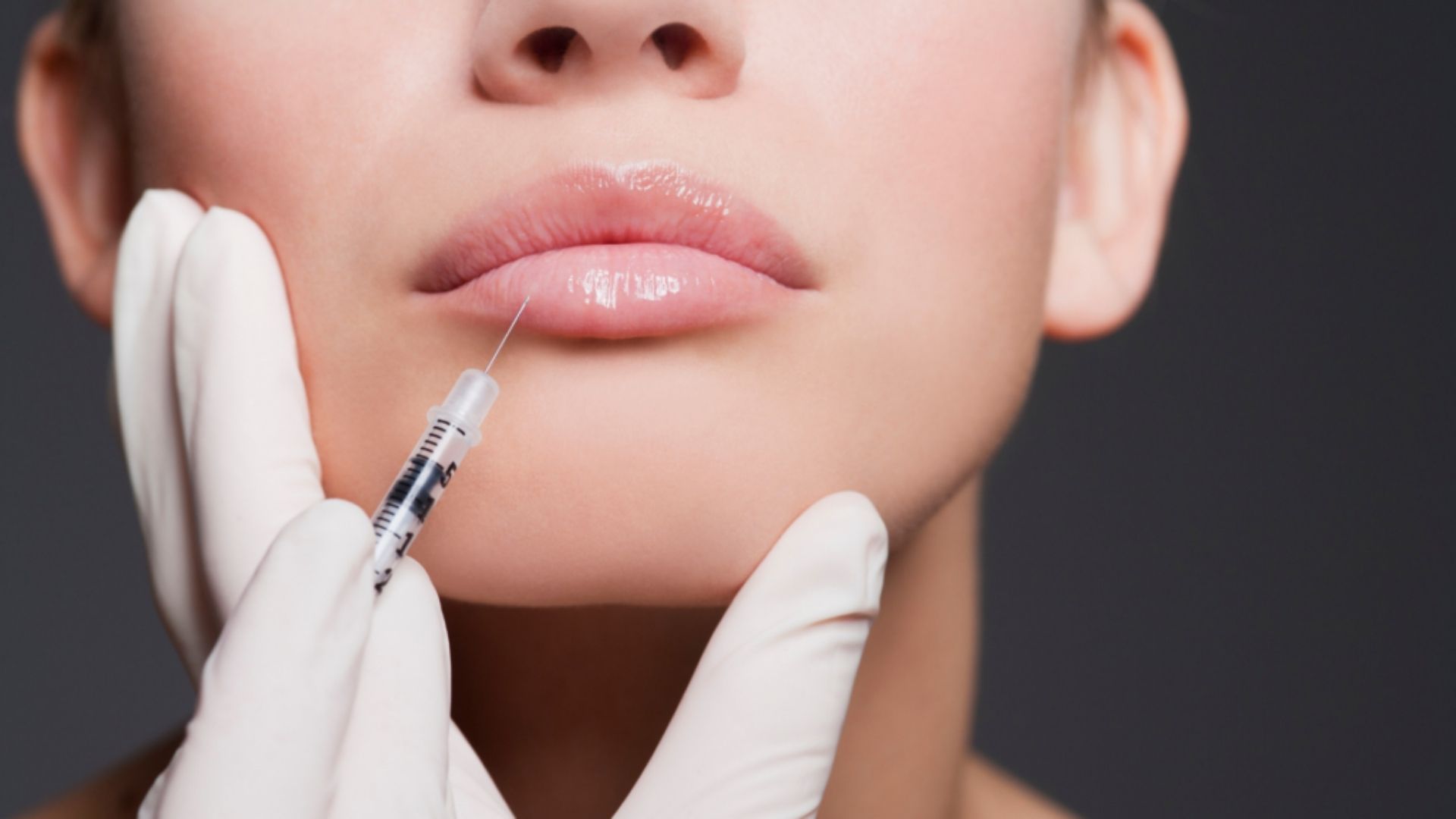 Botox - Michel Aesthetics Dubai