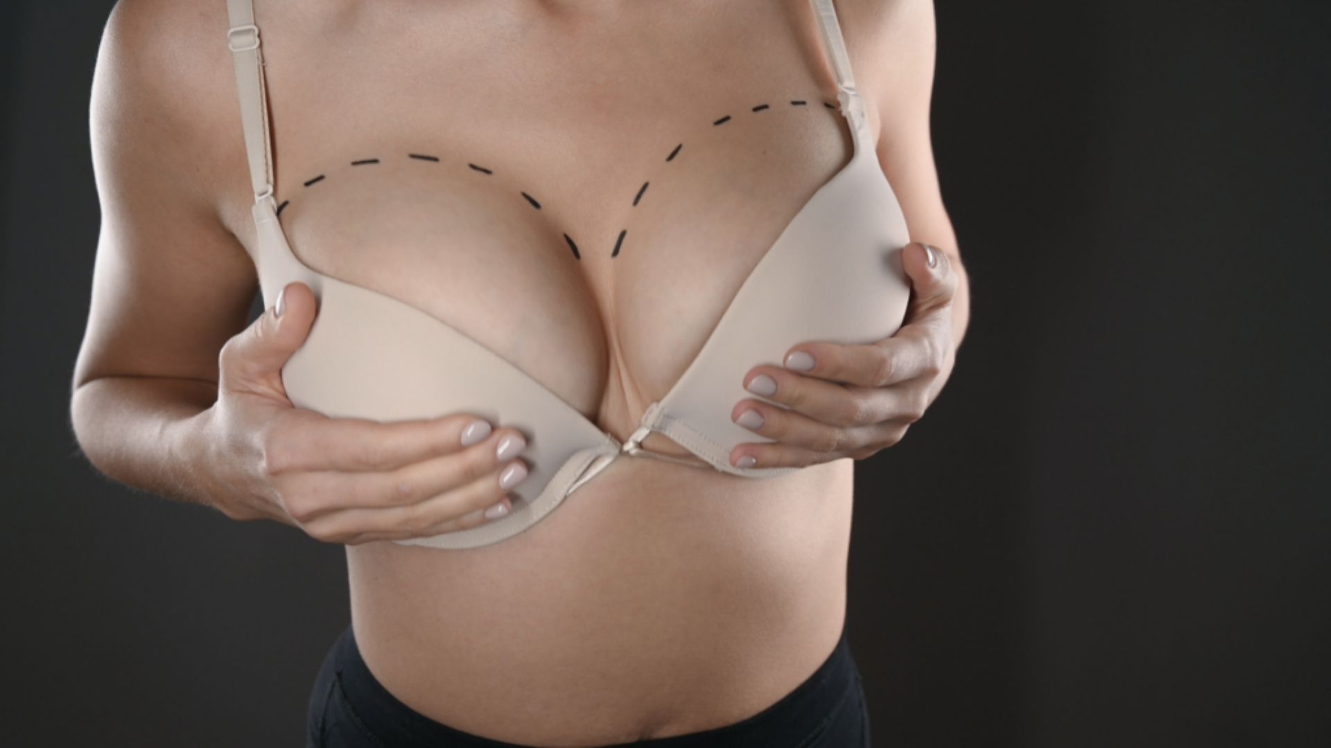 Breast surgery - Michel Aesthetics Dubai