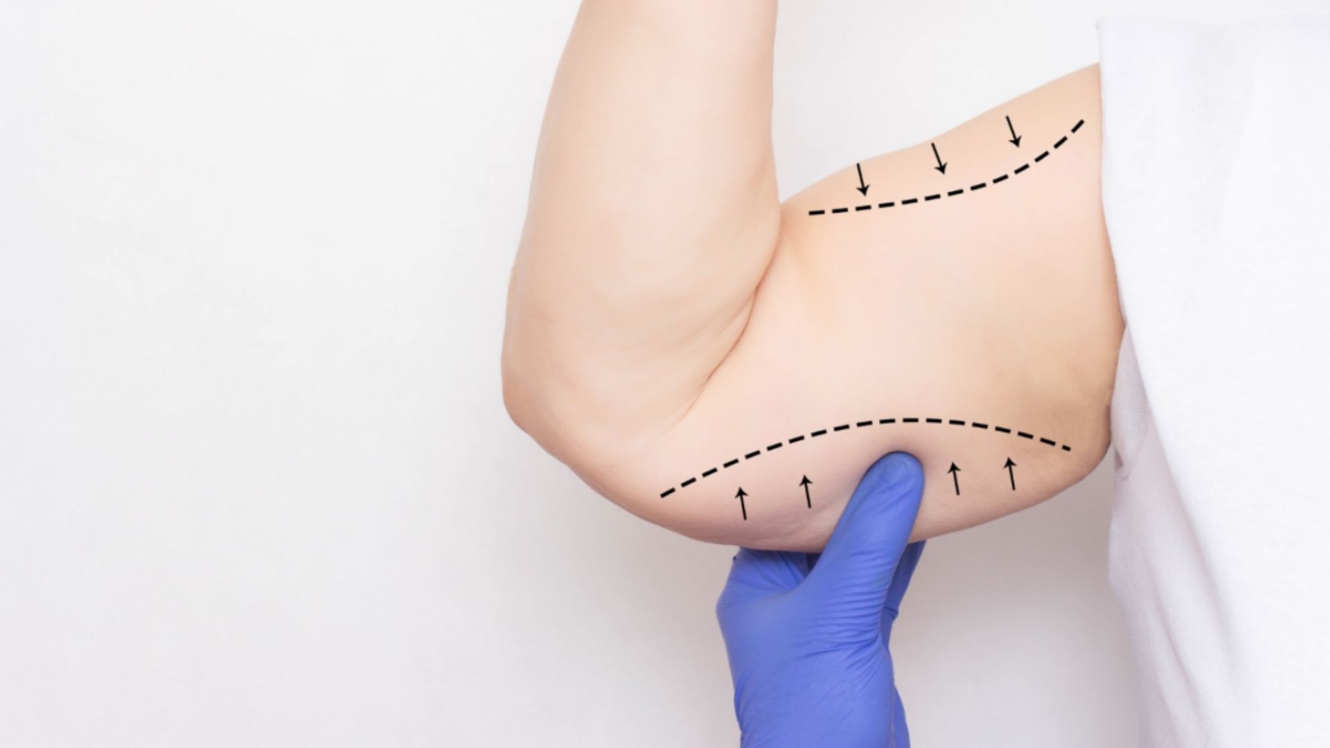 Surgical Lifting Dubai