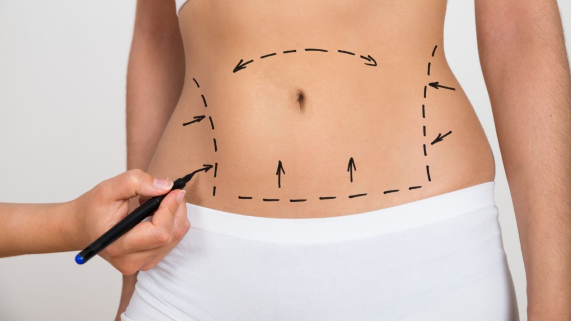 PAL Liposuktion